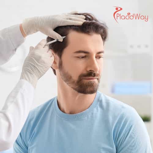 Stem Cell Hair Transplant in Malaysia: The Complete 2025 Guide